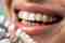 Protetika Smile Centrum Stomatologie